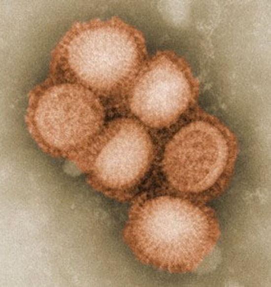 显微镜下的流感病毒