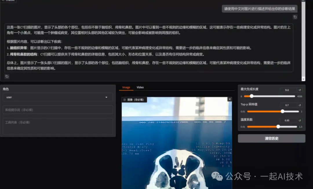 我训练了一个医疗多模态大模型帮家里老人看病-AI.x社区